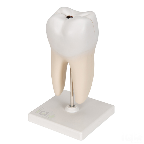 Human Teeth Model, Lower Molar with One Root